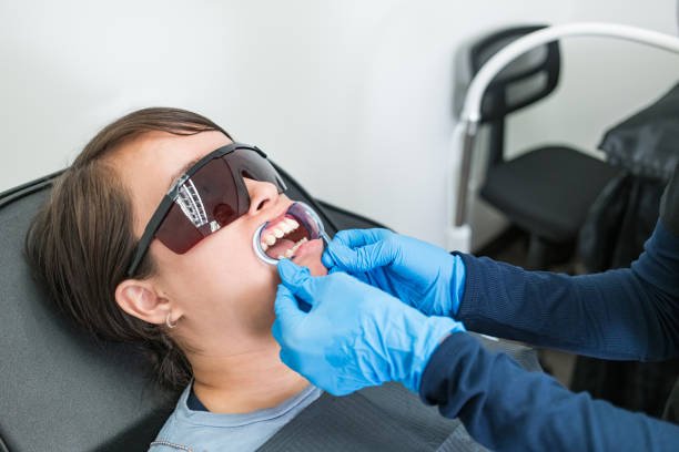 Best Knocked-Out Tooth (Avulsed Tooth) Treatment in Yuc Valley, CA